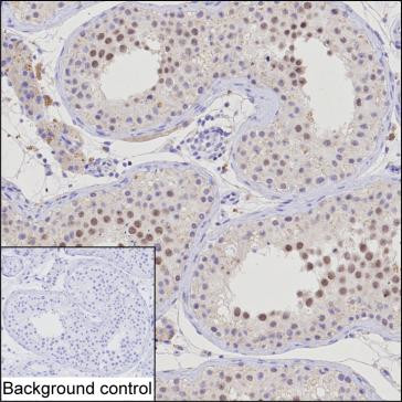 NSMCE1 Antibody in Immunohistochemistry (Paraffin) (IHC (P))