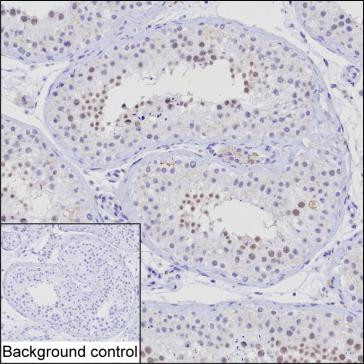 NSMCE1 Antibody in Immunohistochemistry (Paraffin) (IHC (P))