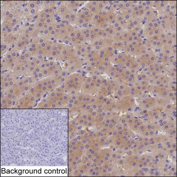 CMPK2 Antibody in Immunohistochemistry (Paraffin) (IHC (P))