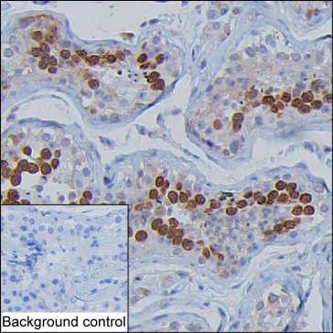 TRAFD1 Antibody in Immunohistochemistry (Paraffin) (IHC (P))