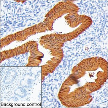 ALP Antibody in Immunohistochemistry (Paraffin) (IHC (P))