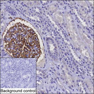 CD142 Antibody in Immunohistochemistry (Paraffin) (IHC (P))