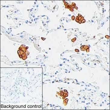 CD204 Antibody in Immunohistochemistry (Paraffin) (IHC (P))