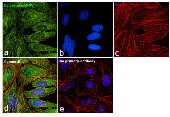 Caldesmon HMW Antibody in Immunocytochemistry (ICC/IF)