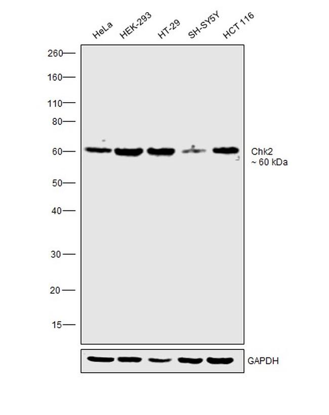 CHK2 Antibody in Western Blot (WB)