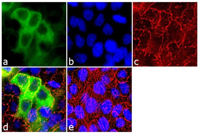 Cytokeratin HMW Antibody in Immunocytochemistry (ICC/IF)