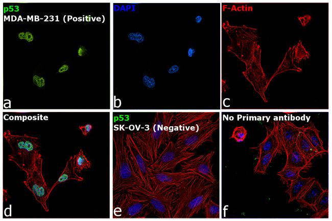 p53 Antibody in Immunocytochemistry (ICC/IF)