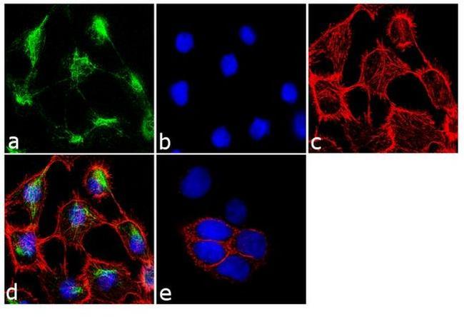 Cytokeratin 5 Antibody in Immunocytochemistry (ICC/IF)