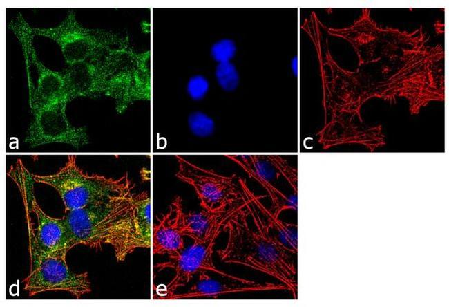 Tau Antibody in Immunocytochemistry (ICC/IF)