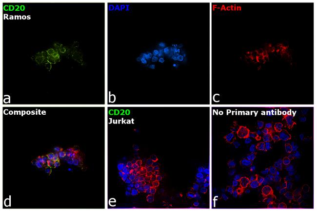 CD20 Antibody in Immunocytochemistry (ICC/IF)