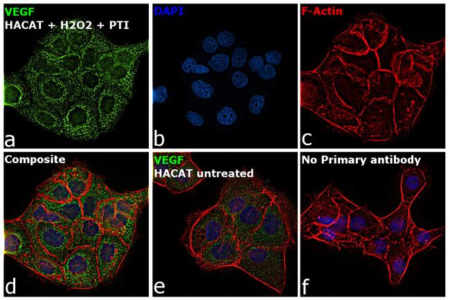 VEGF Antibody in Immunocytochemistry (ICC/IF)