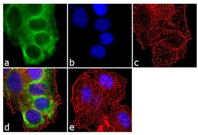 Cytokeratin 8/18 Antibody in Immunocytochemistry (ICC/IF)