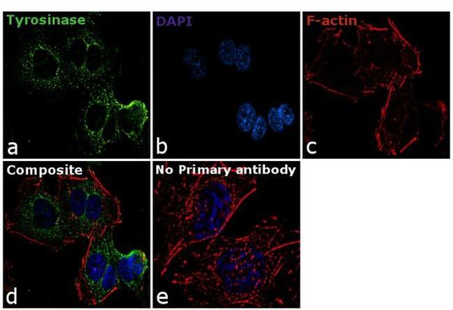 Tyrosinase Antibody in Immunocytochemistry (ICC/IF)