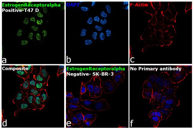 Estrogen Receptor alpha Antibody in Immunocytochemistry (ICC/IF)