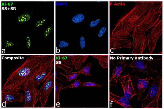 Ki-67 Antibody in Immunocytochemistry (ICC/IF)