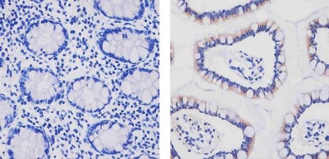 Apolipoprotein B Antibody in Immunohistochemistry (Paraffin) (IHC (P))