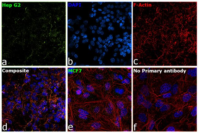 Ferritin Antibody in Immunocytochemistry (ICC/IF)