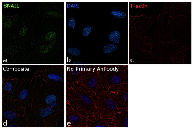 SNAIL Antibody in Immunocytochemistry (ICC/IF)