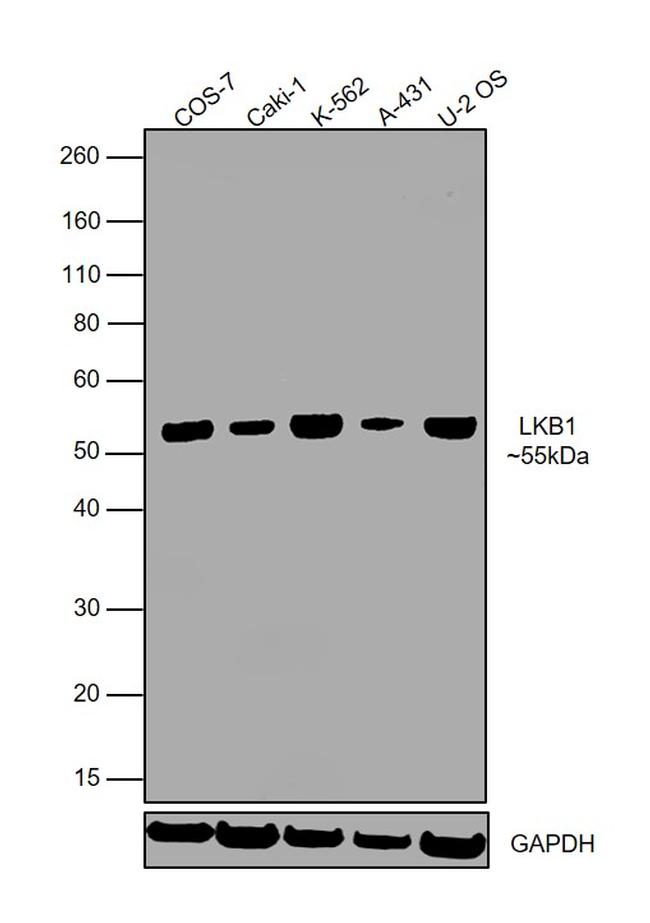 LKB1 Antibody in Western Blot (WB)