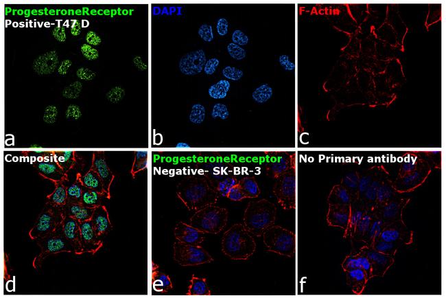 Progesterone Receptor Antibody in Immunocytochemistry (ICC/IF)