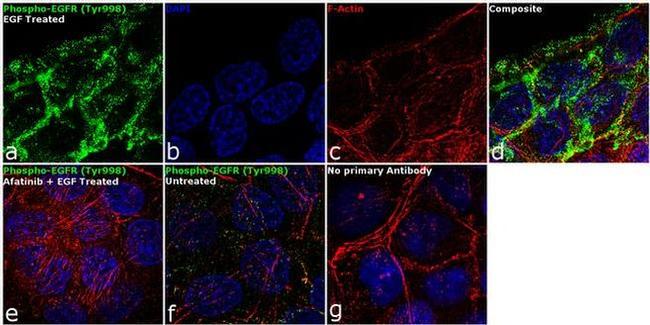 Phospho-EGFR (Tyr998) Antibody in Immunocytochemistry (ICC/IF)