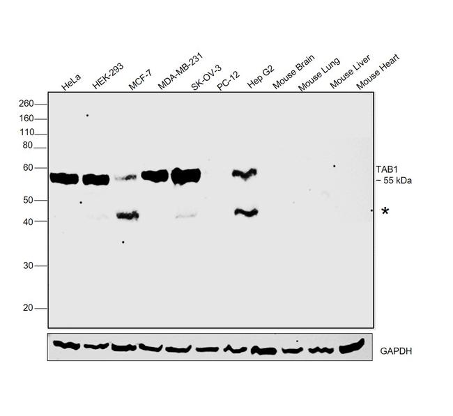 TAB1 Antibody in Western Blot (WB)