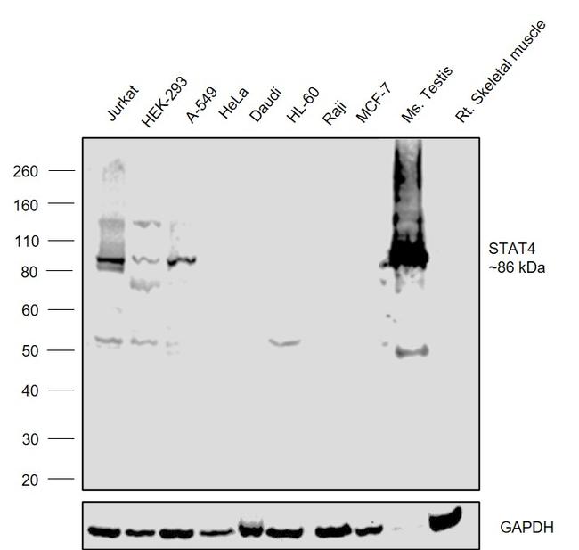 STAT4 Antibody in Western Blot (WB)