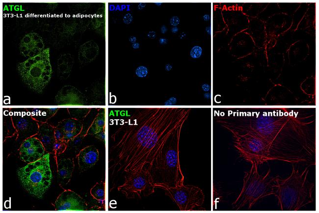 ATGL Antibody in Immunocytochemistry (ICC/IF)