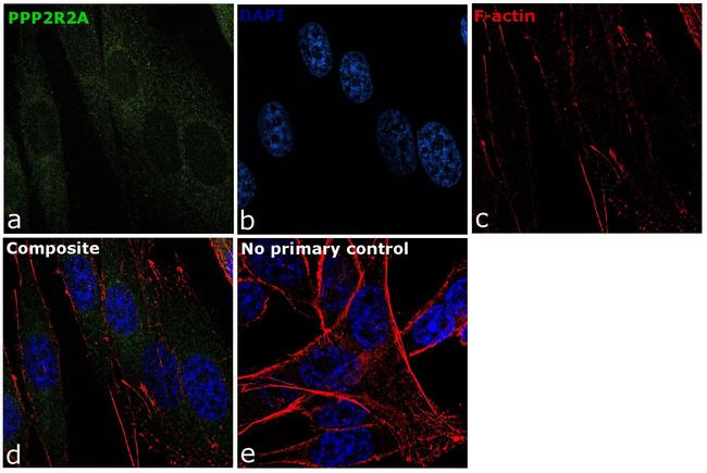 PPP2R2A Antibody in Immunocytochemistry (ICC/IF)