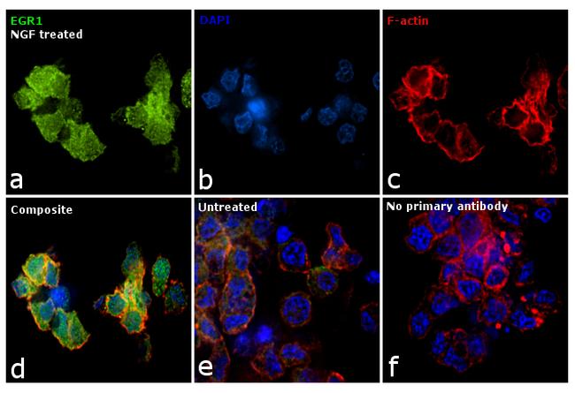 EGR1 Antibody in Immunocytochemistry (ICC/IF)