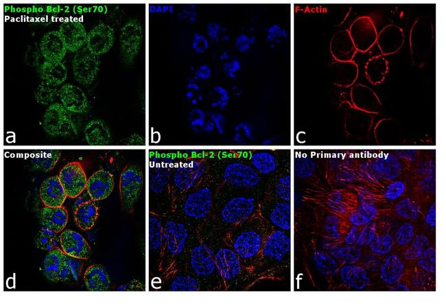 Phospho-Bcl-2 (Ser70) Antibody in Immunocytochemistry (ICC/IF)