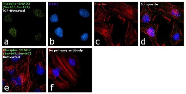 Phospho-SMAD2 (Ser465, Ser467) Antibody in Immunocytochemistry (ICC/IF)