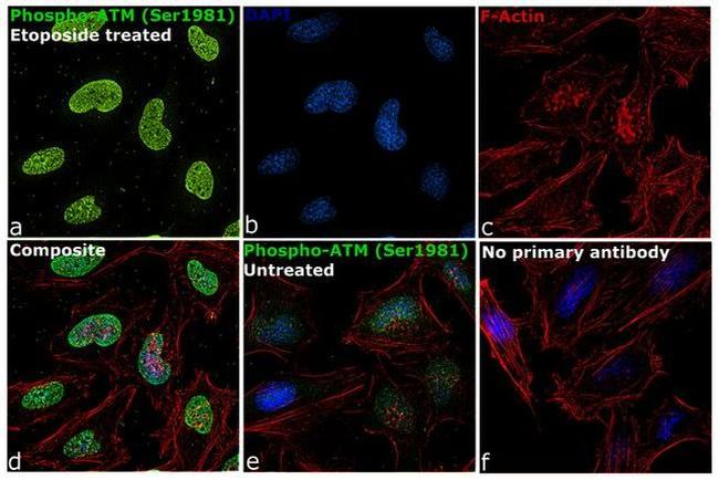 Phospho-ATM (Ser1981) Antibody in Immunocytochemistry (ICC/IF)