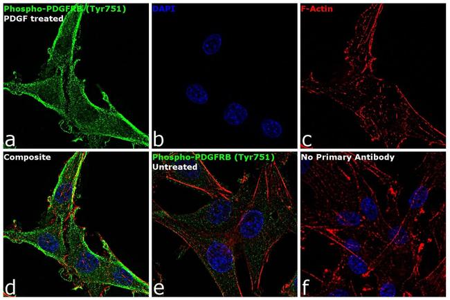 Phospho-PDGFRB (Tyr751) Antibody in Immunocytochemistry (ICC/IF)