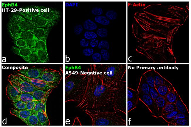 EphB4 Antibody in Immunocytochemistry (ICC/IF)