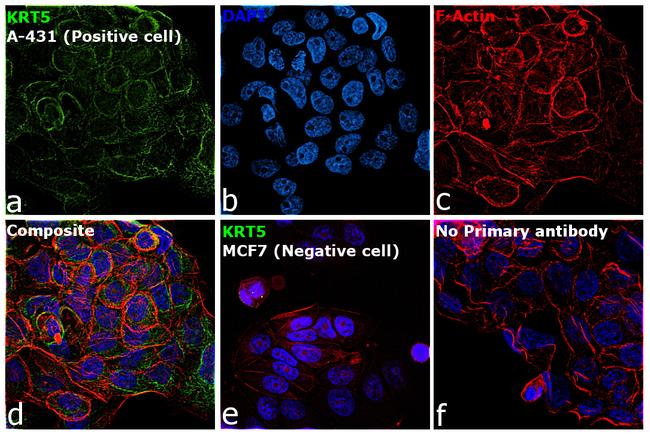 Cytokeratin 5 Antibody in Immunocytochemistry (ICC/IF)