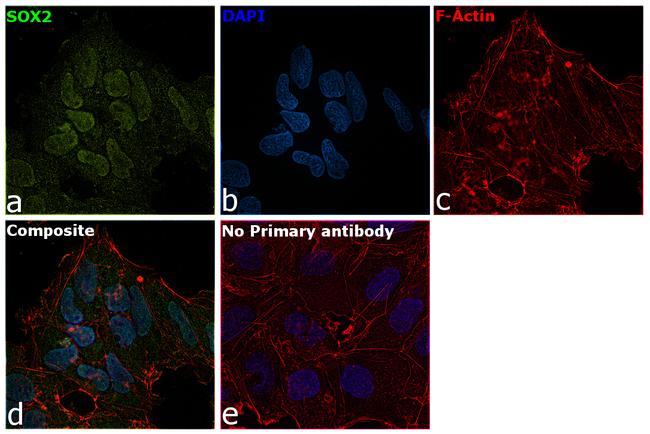 SOX2 Antibody in Immunocytochemistry (ICC/IF)