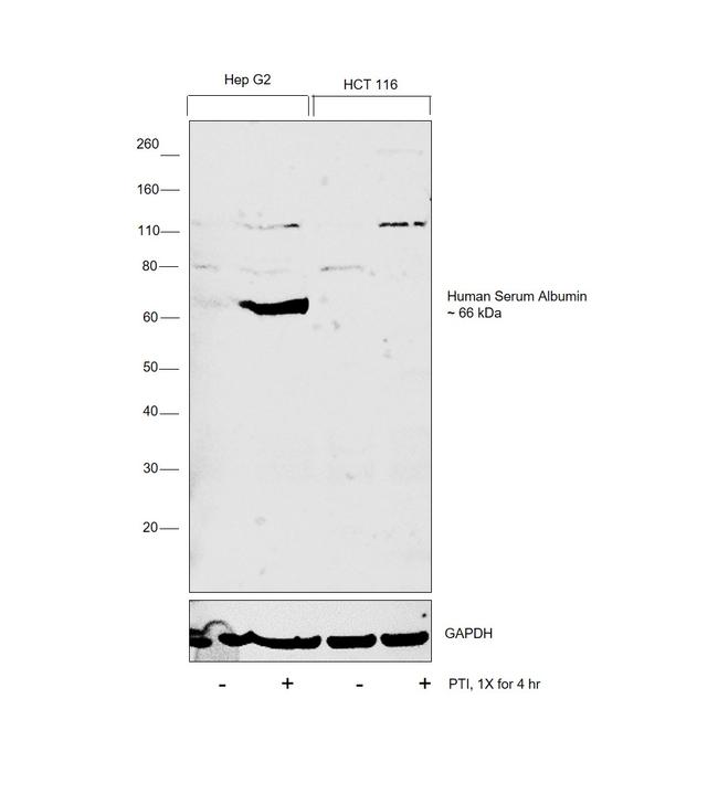 Human Serum Albumin Antibody in Western Blot (WB)