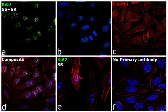 Ki-67 Antibody in Immunocytochemistry (ICC/IF)