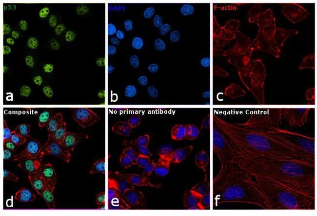 p53 Antibody in Immunocytochemistry (ICC/IF)