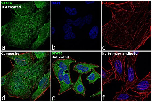 STAT6 Antibody in Immunocytochemistry (ICC/IF)