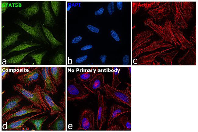 STAT5 beta Antibody in Immunocytochemistry (ICC/IF)