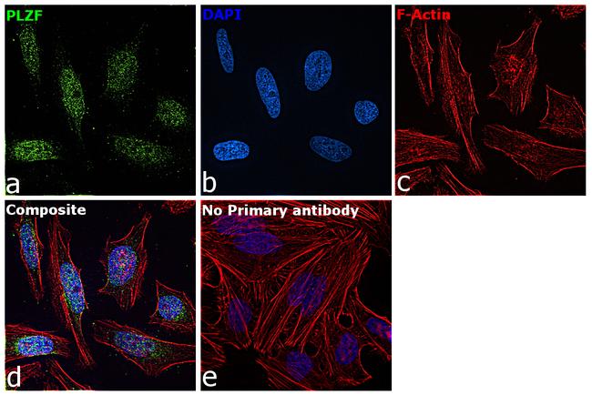 PLZF Antibody in Immunocytochemistry (ICC/IF)