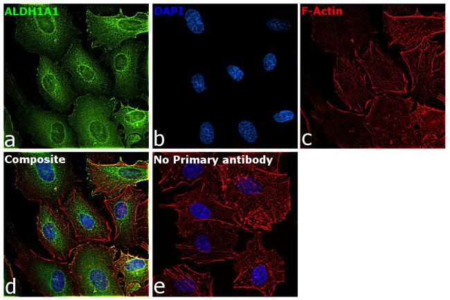 ALDH1A1 Antibody in Immunocytochemistry (ICC/IF)