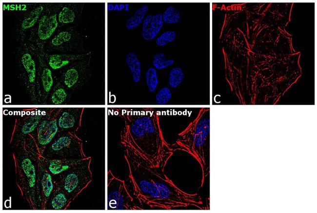 MSH2 Antibody in Immunocytochemistry (ICC/IF)