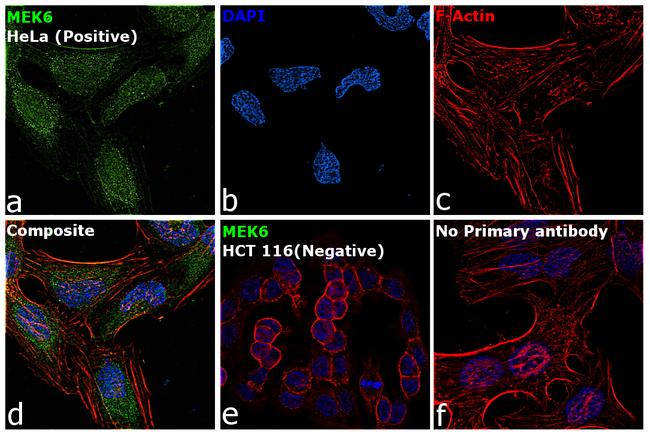 MEK6 Antibody in Immunocytochemistry (ICC/IF)