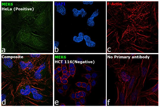 MEK6 Antibody in Immunocytochemistry (ICC/IF)