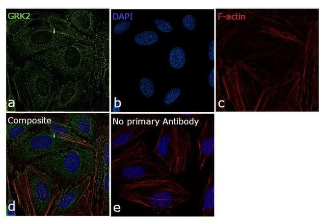 GRK2 Antibody in Immunocytochemistry (ICC/IF)