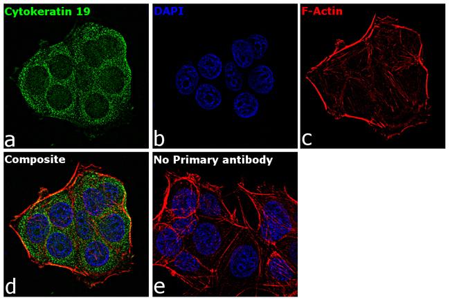 Cytokeratin 19 Antibody in Immunocytochemistry (ICC/IF)