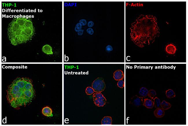 MMP9 Antibody in Immunocytochemistry (ICC/IF)